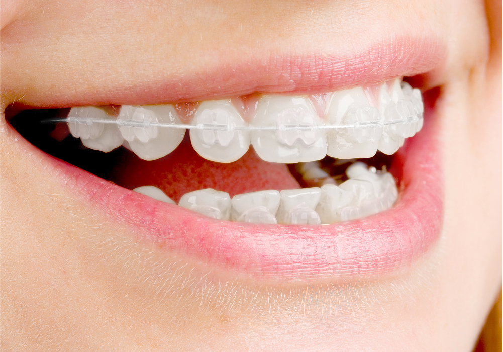 マルチブラケット装置