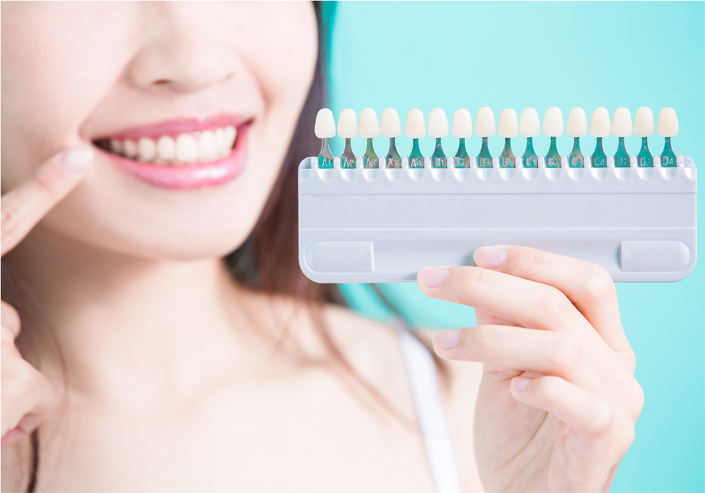 ホワイトニング